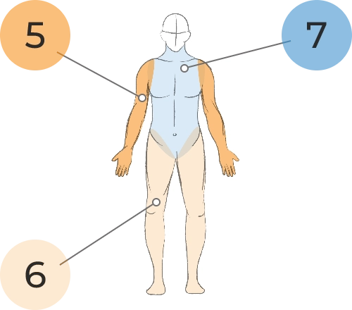 Sketch of body with the arms shaded in orange, the neck and torso shaded in light blue, and the legs shaded in beige. The numbers 5, 6, and 7 sit outside of the sketch, with a callout line between the number 5 and the right arm, a callout line between the number 6 and the lower extremities, and a callout line between the number 7 and the shoulders.