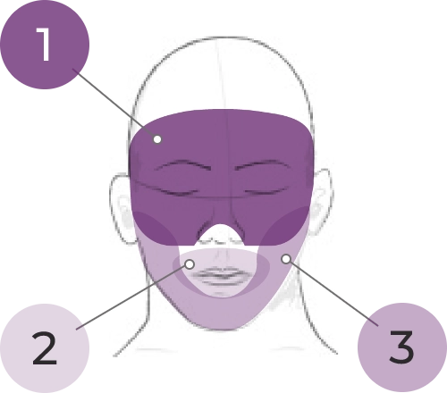Sketch of head showing 3 sites for movement ratings as areas shaded in purple, with a callout line between the number 1 and the muscles of facial expression, a callout line between the number 2 and the lips and perioral area, and a callout line between the number 3 and the jaw.