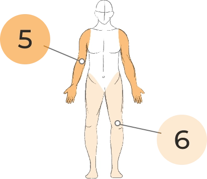 Sketch of body with arms and legs highlighted, with a callout line between the number 5 and the right arm and another between the number 6 and the left leg.